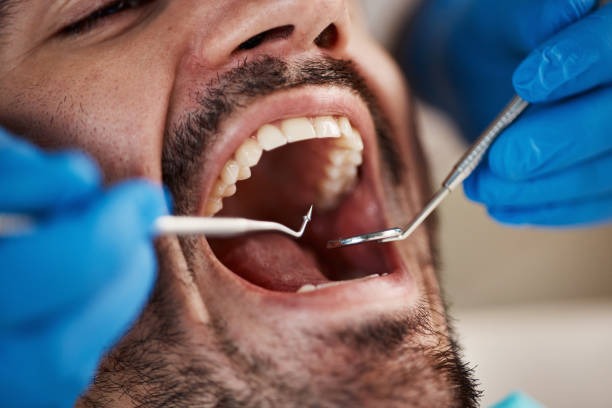 Best Root Canal Treatment  in Masury, OH