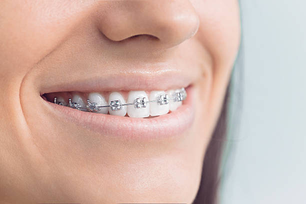 Best Cosmetic Dentistry  in Masury, OH